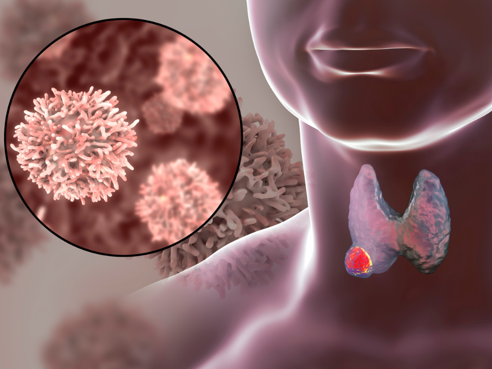 thyroid cancer awareness month